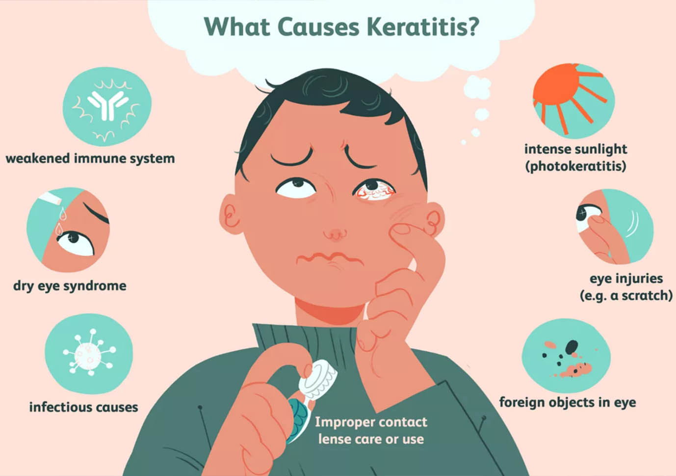 Keratitis