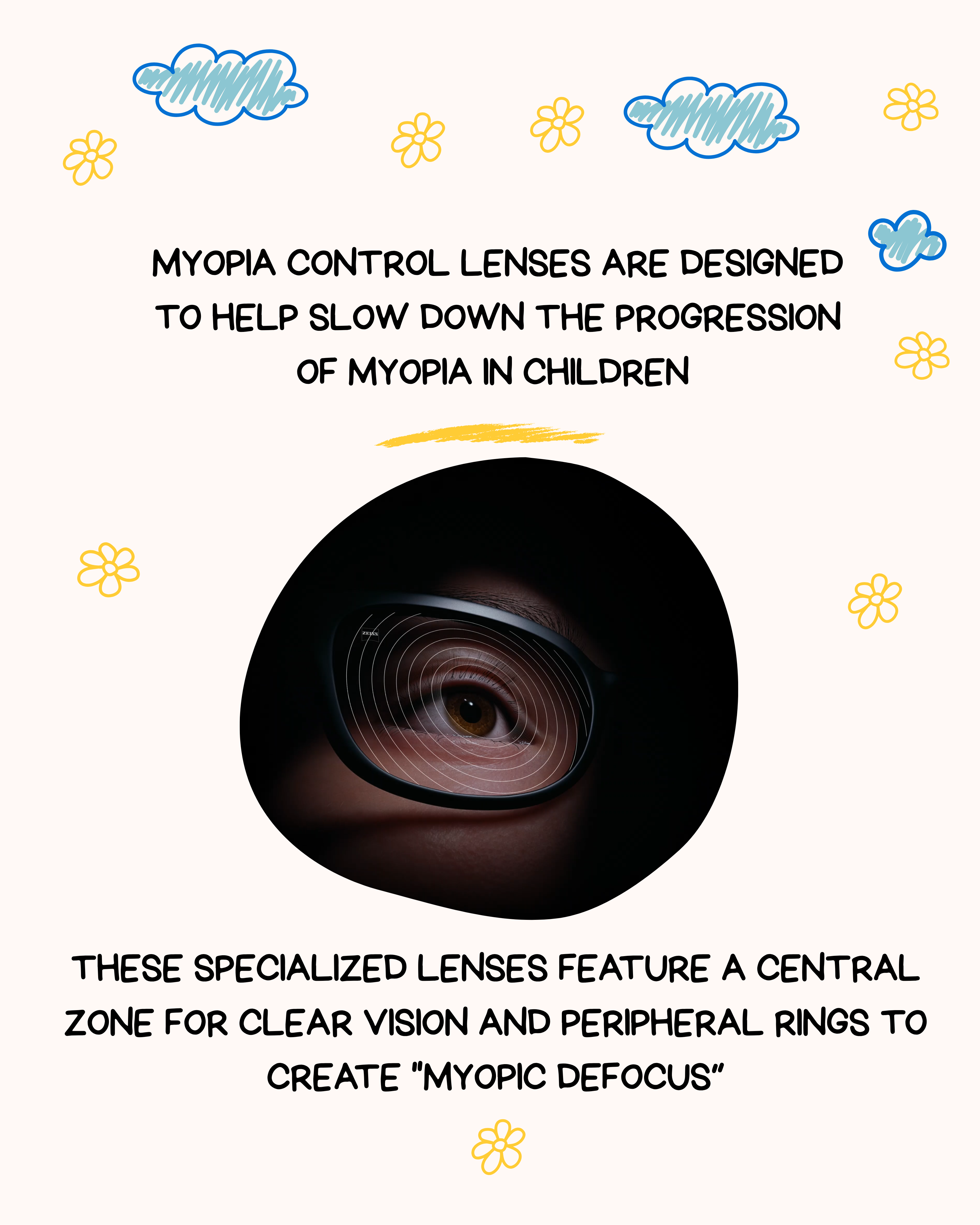 Myopia Control Defocus Lens Feature