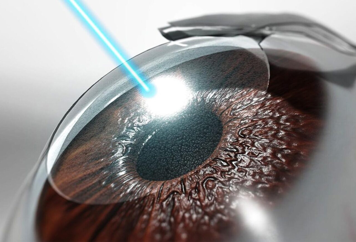Lasik Treatment